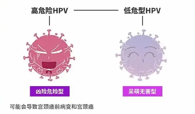 九价HPV真的有必要打吗？